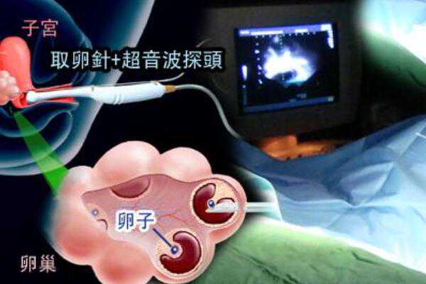 上海第九人民医院试管婴儿成功率高?,在上海做三代试管的成功率能达到多少？