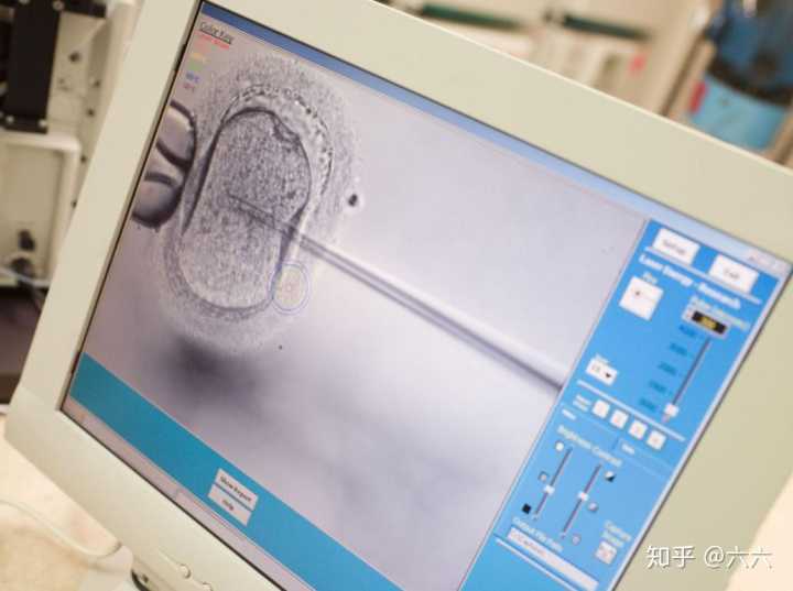 北京能做供卵试管婴儿的十大私立生殖医院有哪些？-iphone7官方膜评测