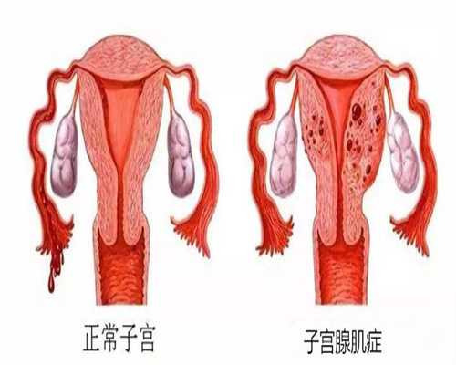 广州助孕中心_什邡完美交出高质量发展的时代答