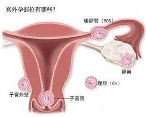 上海有没有代孕公司_寻找上海同居代孕女_专家称