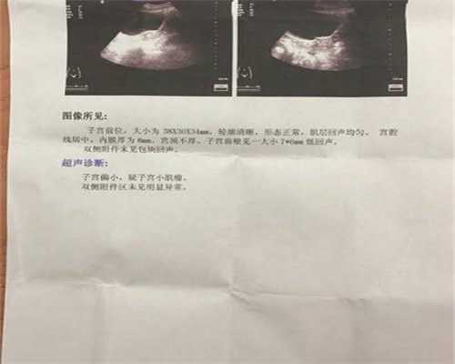 上海代怀孕妈妈_上海代生孩子子多少钱_快速好孕