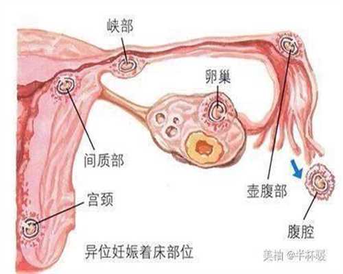 上海怎么代生小孩:怀孕期间做几次B超好