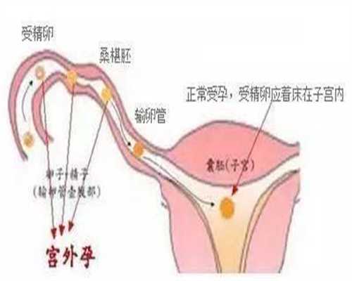 上海哪里有靠谱的供卵代怀孕:抽血检查怀孕准确