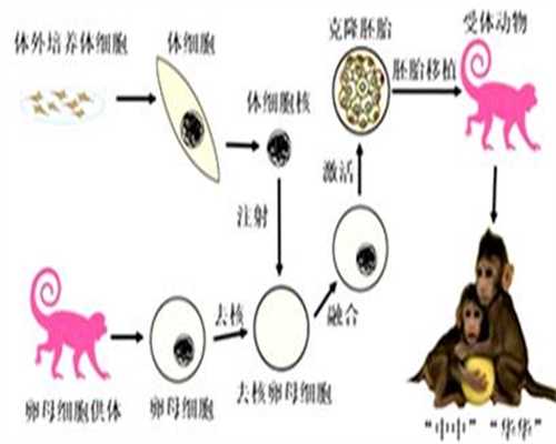 上海女人代生小孩:孕中期羊水过多的原因