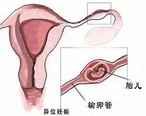 上海专业试管代怀孕:上海供卵都到.传承生殖-详细给大家介绍：传承助孕中心